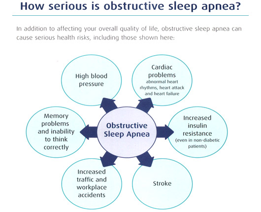 How serious is obstructive sleep apnea?