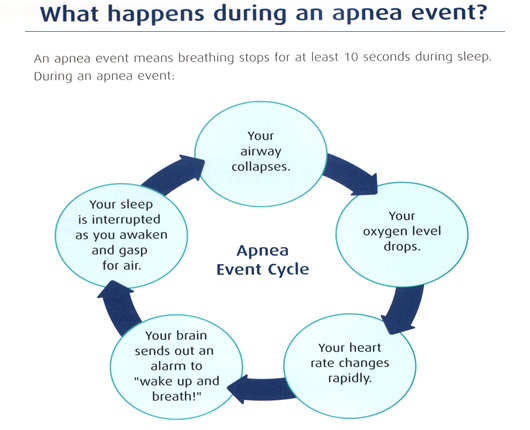 What happens during a sleep apnea event?